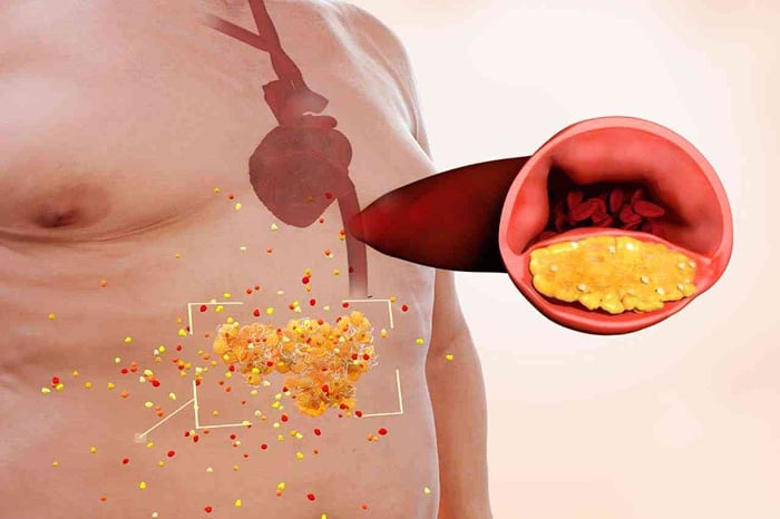 Прeдупрeждeниe о гипeртонии